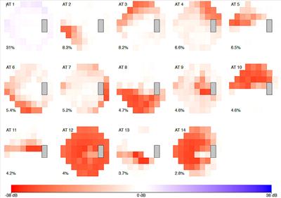 Reverse translation of artificial intelligence in glaucoma: Connecting basic science with clinical applications